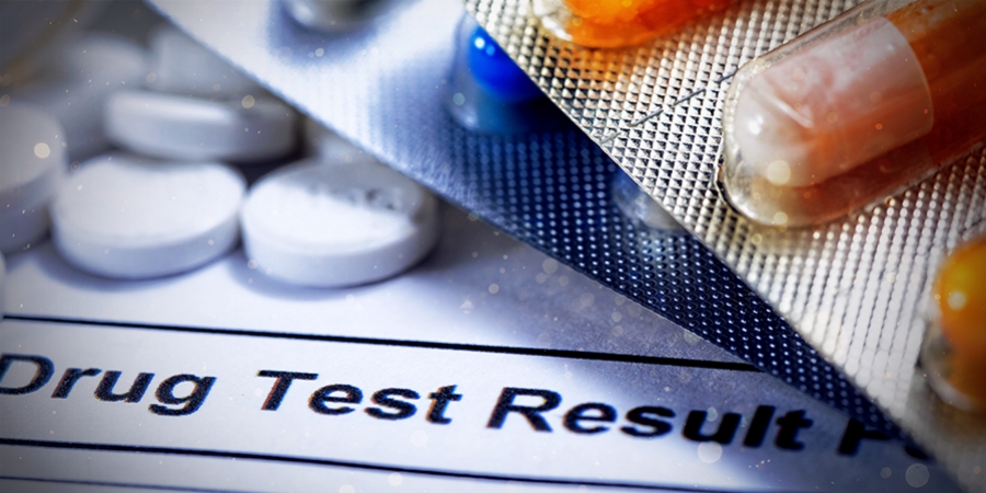 Do Magic Mushrooms and Truffles Show Up On Drug Tests?